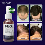 FEG Plus

FEG Plus Hair Growth Spray
