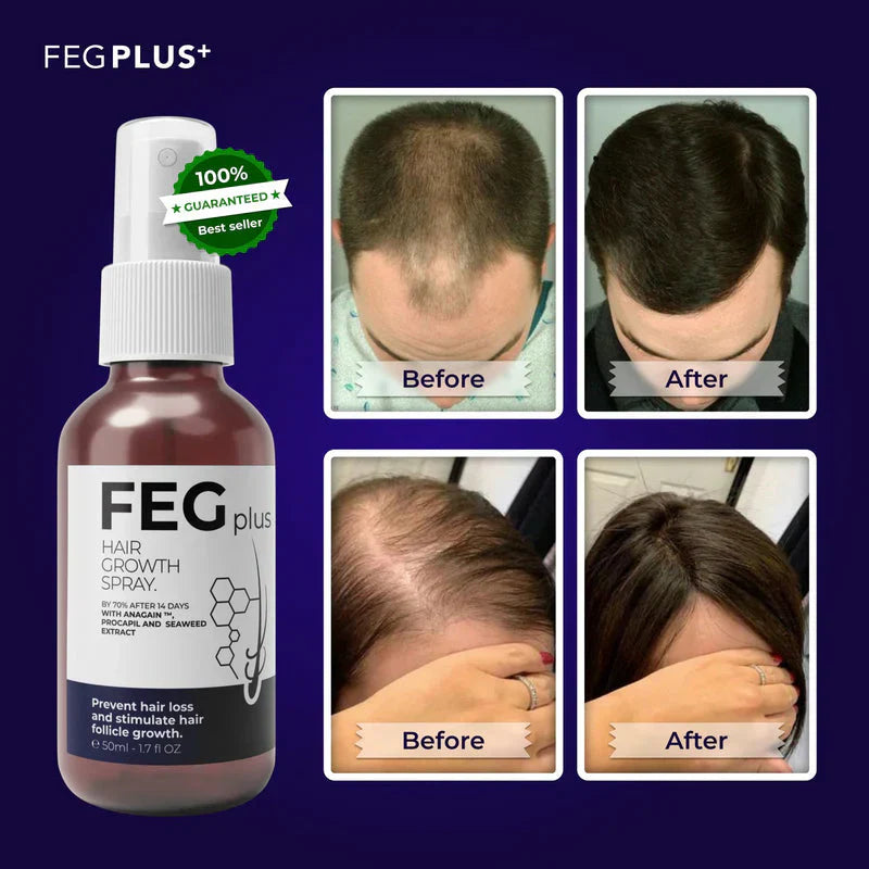 FEG Plus

FEG Plus Hair Growth Spray